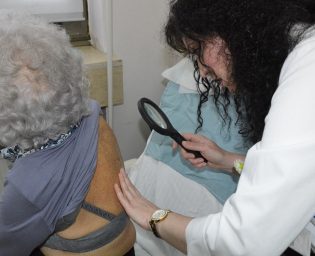 0505_melanom_koza_dermatolog_ukc