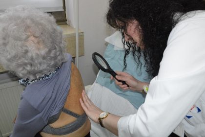 0505_melanom_koza_dermatolog_ukc
