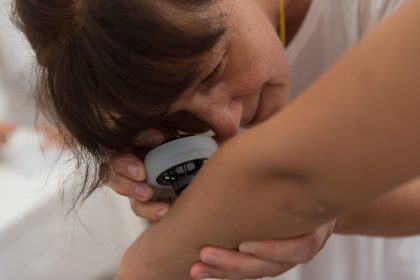 besplatni dermatološki pregledi, dm (1)