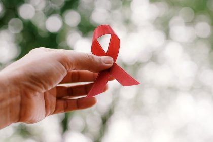 hiv aids