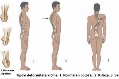 kicma