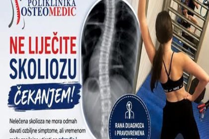 osteomedic 1