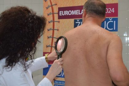 ukc tuzla_euromelanom